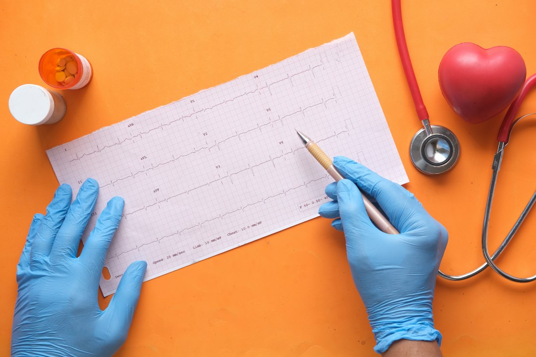 Hands with blue gloves analyzing an electrocardiogram on a graph paper with a stethoscope and heart model nearby