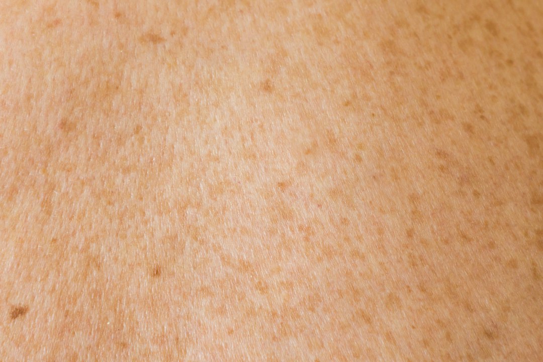 Close-up view of skin texture showing freckles and small blemishes